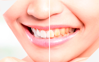 ODONTOLOGIA ESTETICA